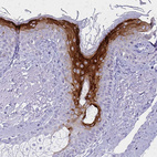 Anti-IVL Antibody