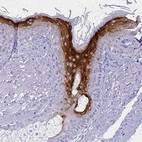 Immunohistochemical staining of human skin shows moderate to strong cytoplasmic positivity in keratinocytes.