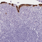 Anti-IVL Antibody