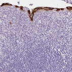 Immunohistochemical staining of human tonsil shows moderate to strong cytoplasmic positivity in squamous epithelial cells.