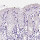 Anti-IVL Antibody