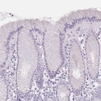 Immunohistochemical staining of human stomach shows no cytoplasmic positivity in glandular cells as expected.