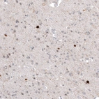 Immunohistochemical staining of human cerebral cortex shows strong cytoplasmic positivity in a subset of neurons.