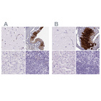 Anti-KRT12 Antibody