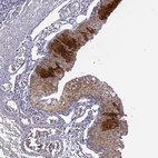 Immunohistochemical staining of human eye using Anti-KRT12 antibody HPA055217.