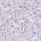 Immunohistochemical staining of human liver using Anti-KRT12 antibody HPA055217.