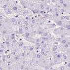 Immunohistochemical staining of human liver using Anti-KRT12 antibody HPA055217.