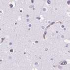Immunohistochemical staining of human cerebral cortex using Anti-KRT12 antibody HPA055217.