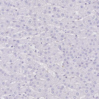 Anti-TMEM79 Antibody