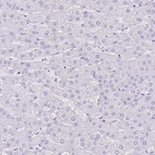 Immunohistochemical staining of human liver shows no positivity in hepatocytes.