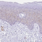 Immunohistochemical staining of human skin shows weak membranous/cytoplasmic positivity in squamous epithelial cells.