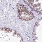 Immunohistochemical staining of human prostate strong membranous/cytoplasmic positivity in glandular cells.