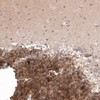 Immunohistochemical staining of human cerebellum shows moderate to strong positivity in granular layer cells.