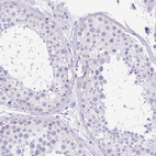 Anti-TMEM79 Antibody