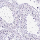 Immunohistochemical staining of human testis shows no positivity in cells in seminiferous ducts.