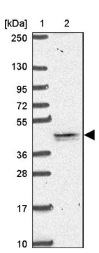 Lane 1: Marker [kDa] 250, 130, 95, 72, 55, 36, 28, 17, 10_br/_Lane 2: Human cell line RT-4