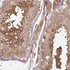 Anti-C2orf73 Antibody
