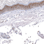 Anti-MRGPRX2 Antibody