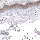 Immunohistochemical staining of human skin shows moderate membranous/cytoplasmic-membranous positivity in squamous epithelial cells.