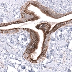 Immunohistochemical staining of human fallopian tube shows strong membranous/cytoplasmic-membranous positivity in glandular cells.