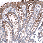 Immunohistochemical staining of human colon shows strong membranous/cytoplasmic-membranous positivity in glandular cells.