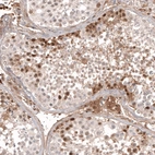 Immunohistochemical staining of human testis shows moderate to strong cytoplasmic and nuclear positivity in cells in seminiferous ducts.