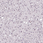 Anti-TCFL5 Antibody