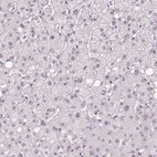 Immunohistochemical staining of human liver shows no positivity in hepatocytes as expected.