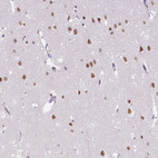 Immunohistochemical staining of human cerebral cortex shows strong nuclear positivity in neurons.