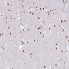 Immunohistochemical staining of human cerebral cortex shows strong nuclear positivity in neurons.