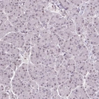 Immunohistochemical staining of human pancreas shows no positivity in exocrine glandular cells as expected.