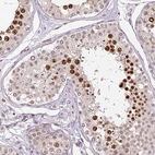 Immunohistochemical staining of human testis shows strong nuclear positivity in cells in seminiferous ducts.