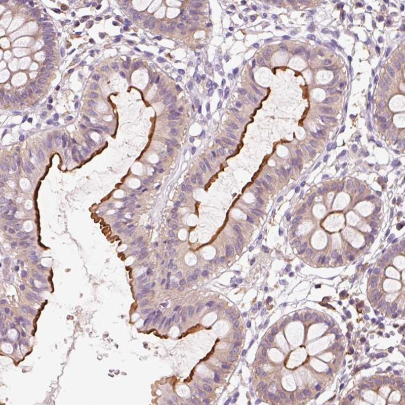 Anti-OR8K1 Antibody