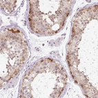 Anti-SYNE3 Antibody
