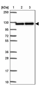Lane 1: Marker [kDa] 250, 130, 95, 72, 55, 36, 28, 17, 10_br/_Lane 2: Human cell line RT-4_br/_Lane 3: Human cell line U-251MG sp