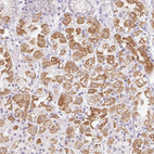 Anti-ITPK1 Antibody