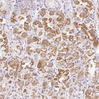 Immunohistochemical staining of human Stomach shows moderate granular cytoplasmic positivity in enteroendocrine cells.