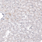 Immunohistochemical staining of human liver shows no positivity in hepatocytes as expected.