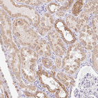Immunohistochemical staining of human Kidney shows moderate granular cytoplasmic positivity in cells in tubules.
