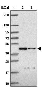 Lane 1: Marker [kDa] 250, 130, 95, 72, 55, 36, 28, 17, 10_br/_Lane 2: Human cell line RT-4_br/_Lane 3: Human cell line U-251MG sp
