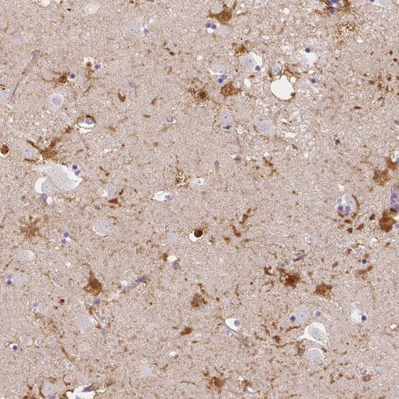 Anti-LRRC36 Antibody