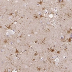 Anti-LRRC36 Antibody