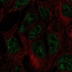 Immunofluorescent staining of human cell line CACO-2 shows localization to nuclear speckles.
