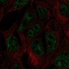 Anti-DNMT3L Antibody