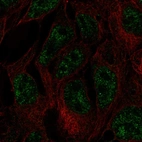 Immunofluorescent staining of human cell line CACO-2 shows localization to nuclear speckles.