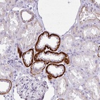 Anti-NHLH2 Antibody