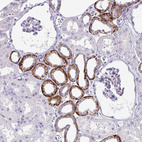 Anti-NHLH2 Antibody