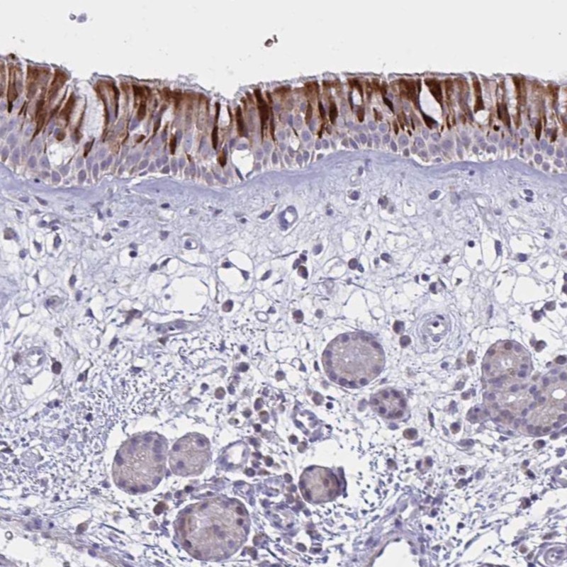 Anti-VWC2 Antibody