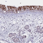 Anti-VWC2 Antibody