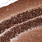 Immunohistochemical staining of mouse cerebellum shows strong cytoplasmic positivity in cells in granular layer.